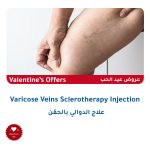 Varicose-injection