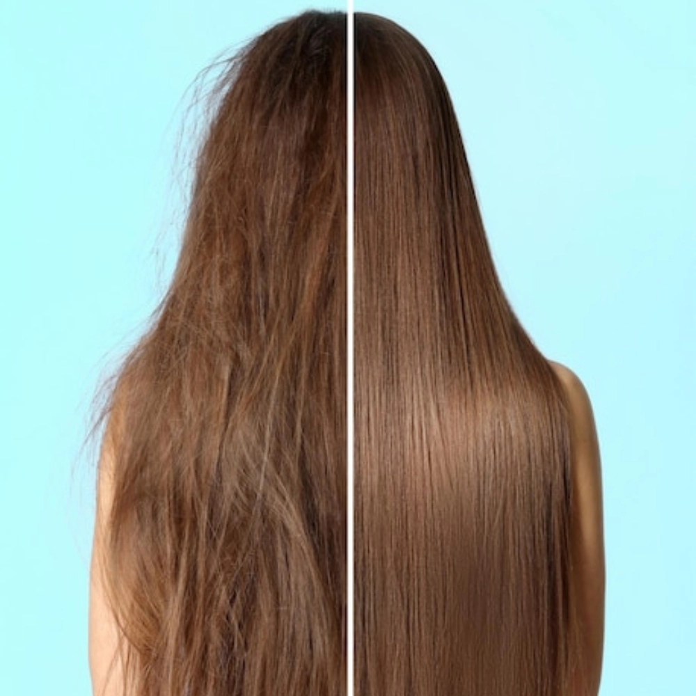 Brittle Hair Treatment1