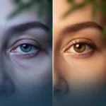 1ml Filler (under eye) - Image 2