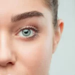 Blepharoplasty - Image 2