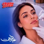 تجديد الشفاه بالليزر