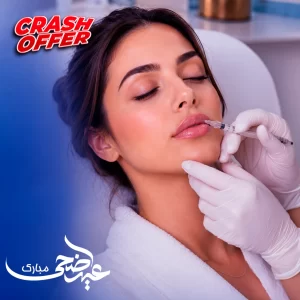 فيلر للشفاه (1مل)