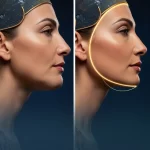 Nefertiti (rejuvenating and lifting) - Image 2