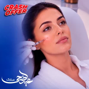 حقن إبرة النضارة (٢ مل )