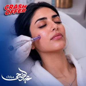 جلسة ديرمابن